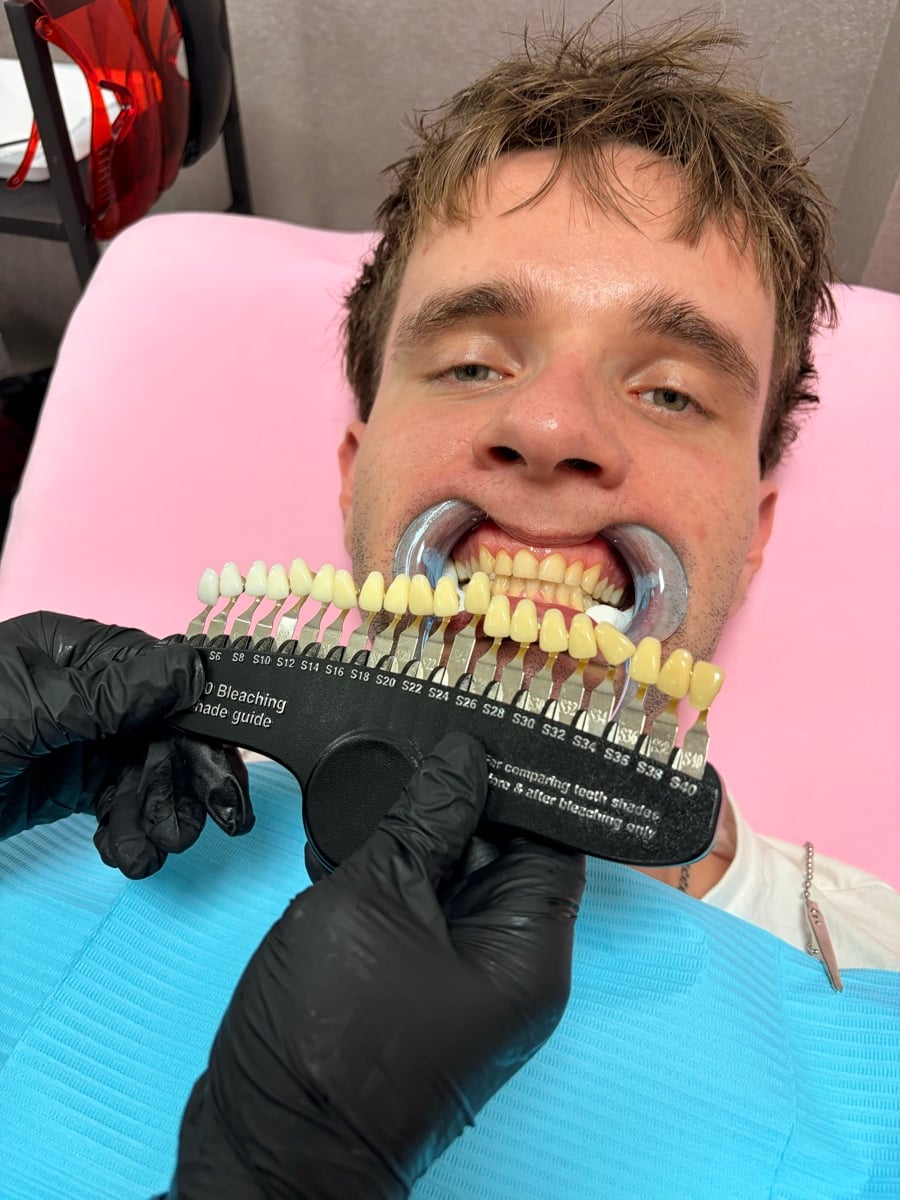 Primero evalúo el estado de tus dientes